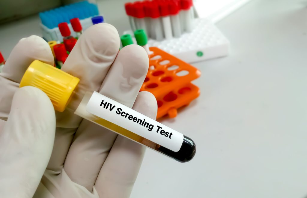Prevencio vih scaled 1