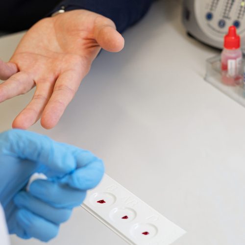 doctor taking an analysis, test from the finger of patient to determine the blood group and Rh factor in the laboratory